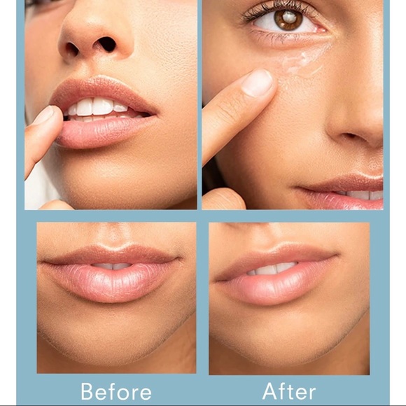 TRUE & LUSCIOUS FLOWERDOSE LIP & EYE SERUM - Picture 2 of 14